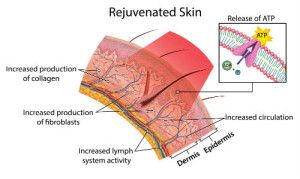 PDT PhotoDynamic Facial